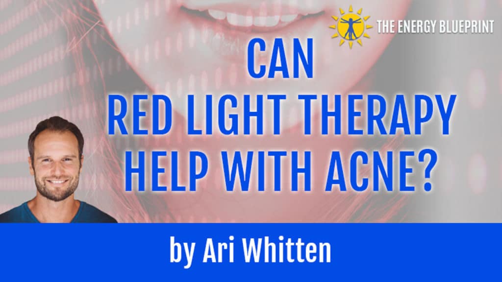 RLT and Acne